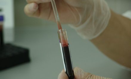77% wollen Krankenkassen Kosten für Down Syndrom-Bluttests zahlen lassen